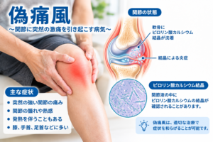 偽痛風のイメージ画像